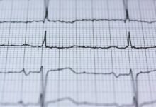 digital flow fusion pulse